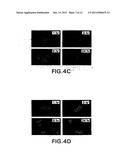 COMPOSITIONS AND METHODS FOR INHIBITING NF-KB MEDIATED TUMORIGENICITY AND     ADHESION-DEPENDENT SURVIVAL OF CANCER CELLS diagram and image