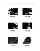 COMPOSITIONS AND METHODS FOR INHIBITING NF-KB MEDIATED TUMORIGENICITY AND     ADHESION-DEPENDENT SURVIVAL OF CANCER CELLS diagram and image