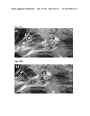 SURFACE-MODIFIED POLYMER FILMS diagram and image