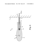 METHOD OF TREATING INCONTINENCE diagram and image