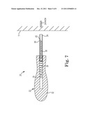 METHOD OF TREATING INCONTINENCE diagram and image