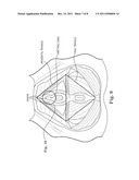 METHOD OF TREATING INCONTINENCE diagram and image