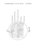 METHOD OF TREATING INCONTINENCE diagram and image