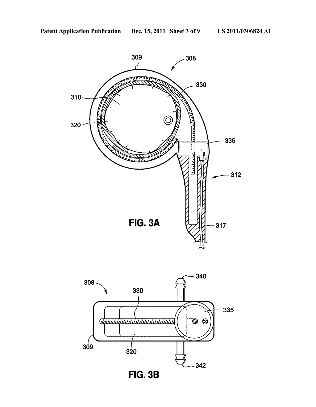 REMOTELY ADJUSTABLE GASTRIC BANDING SYSTEM - diagram, schematic, and image 04