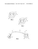 OVER MOLDED IMPLANTABLE DEVICE TO PROTECT TUBING FROM PUNCTURE diagram and image