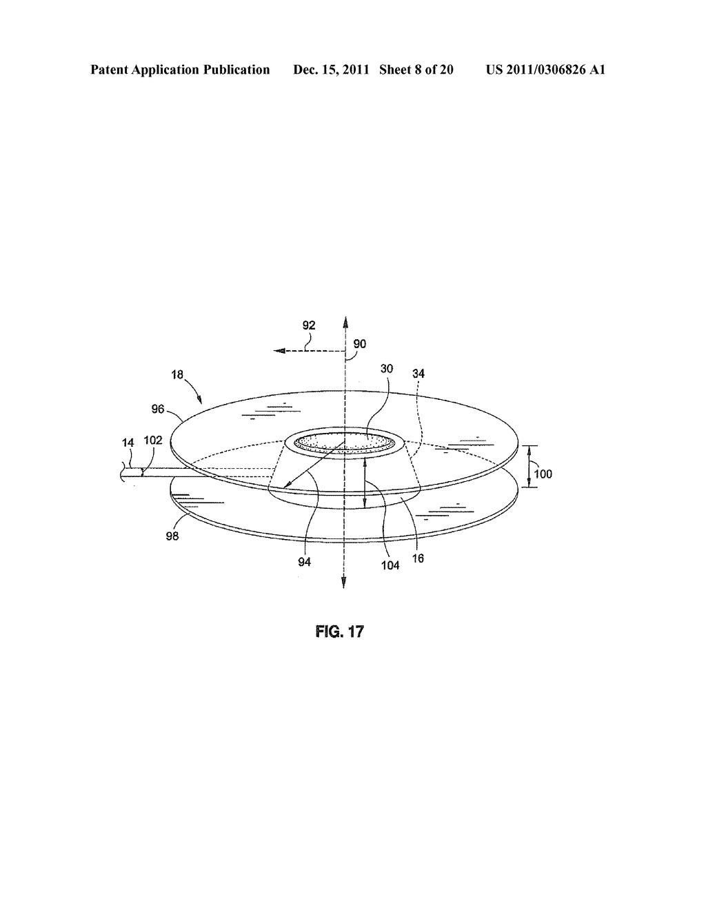 OVER MOLDED IMPLANTABLE DEVICE TO PROTECT TUBING FROM PUNCTURE - diagram, schematic, and image 09