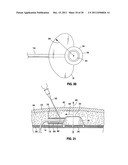 OVER MOLDED IMPLANTABLE DEVICE TO PROTECT TUBING FROM PUNCTURE diagram and image