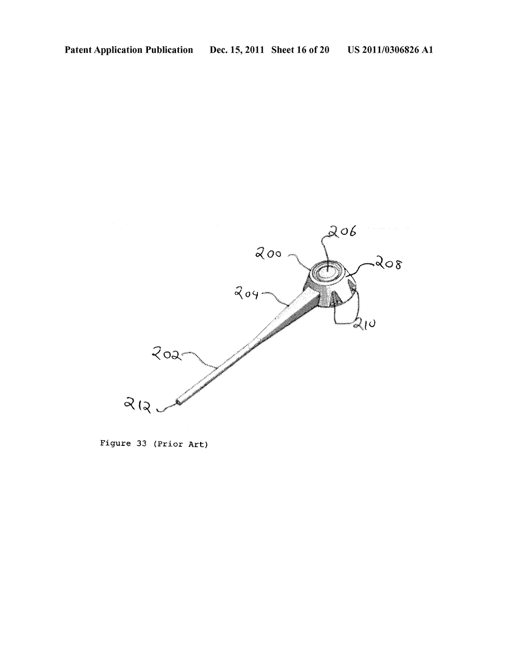 OVER MOLDED IMPLANTABLE DEVICE TO PROTECT TUBING FROM PUNCTURE - diagram, schematic, and image 17