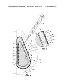 NEEDLE GUARD TO PROTECT ACCESS PORT TUBING diagram and image