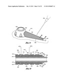 NEEDLE GUARD TO PROTECT ACCESS PORT TUBING diagram and image