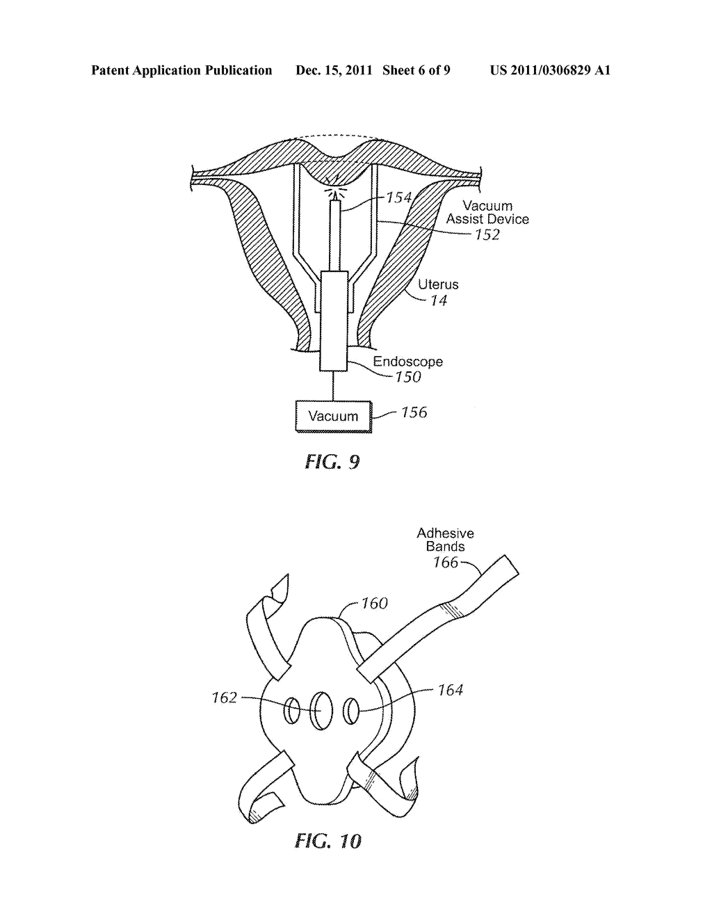 METHODS AND APPARATUS FOR NATURAL ORIFICE VAGINAL HYSTERECTOMY - diagram, schematic, and image 07