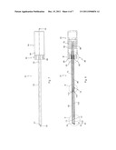 Endoscope diagram and image