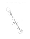 Endoscope diagram and image