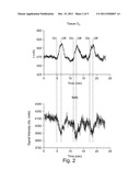 IMPROVEMENTS IN THE ANALYSIS OF NEURONAL ACTIVITY diagram and image