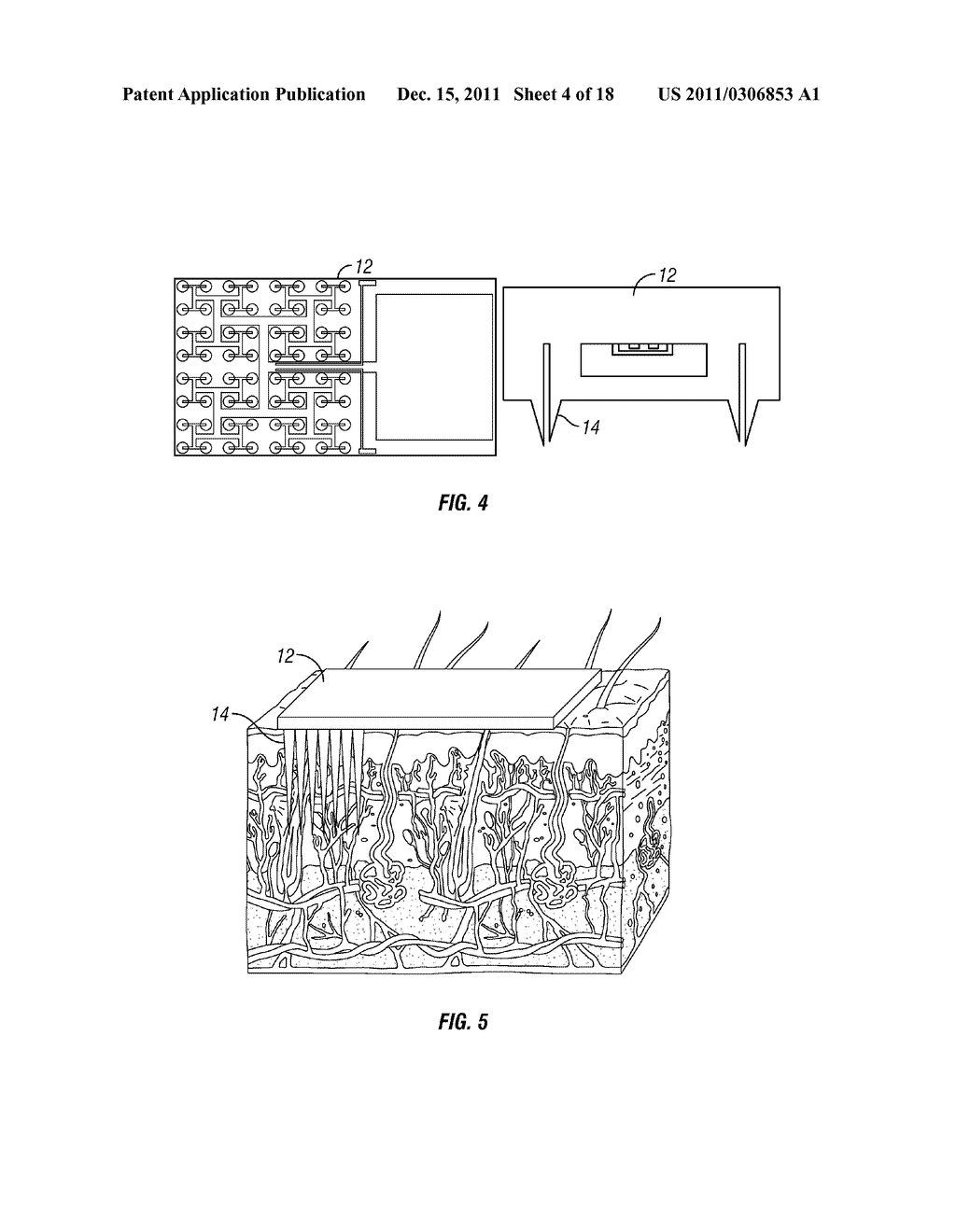 Body fluid sampling/fluid delivery device - diagram, schematic, and image 05