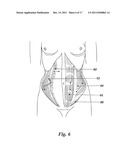 ELECTRODE AND ELECTRODE POSITIONING ARRANGEMENT FOR ABDOMINAL FETAL     ELECTROCARDIOGRAM DETECTION diagram and image