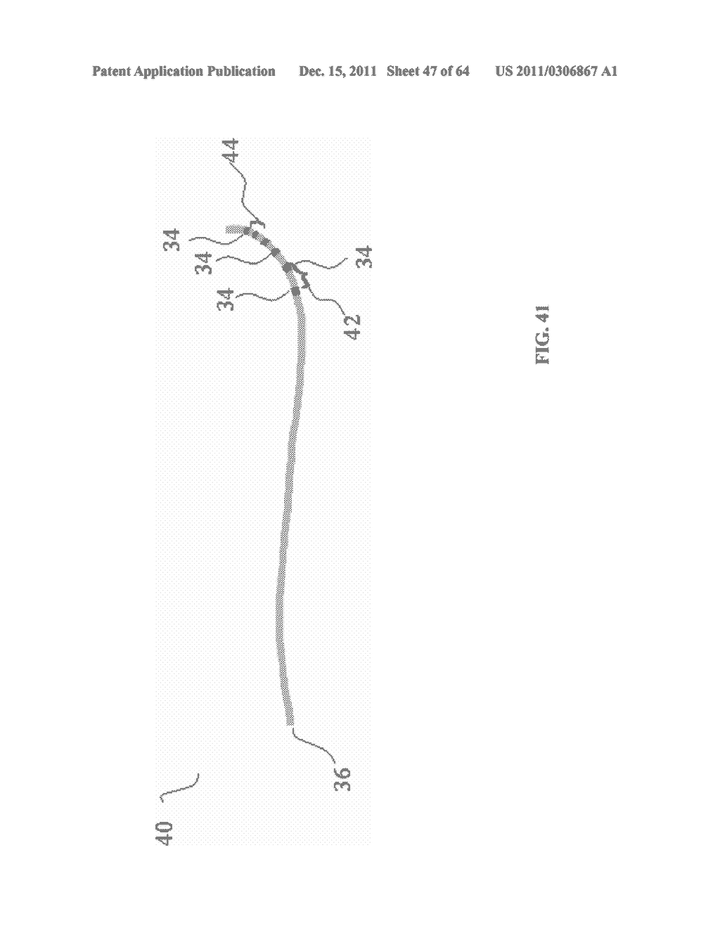 Methods and Systems for Determining Vascular Bodily Lumen Information and     Guiding Medical Devices - diagram, schematic, and image 48