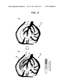 DEVICE AND METHOD FOR MEDICAL IMAGE PROCESSING diagram and image