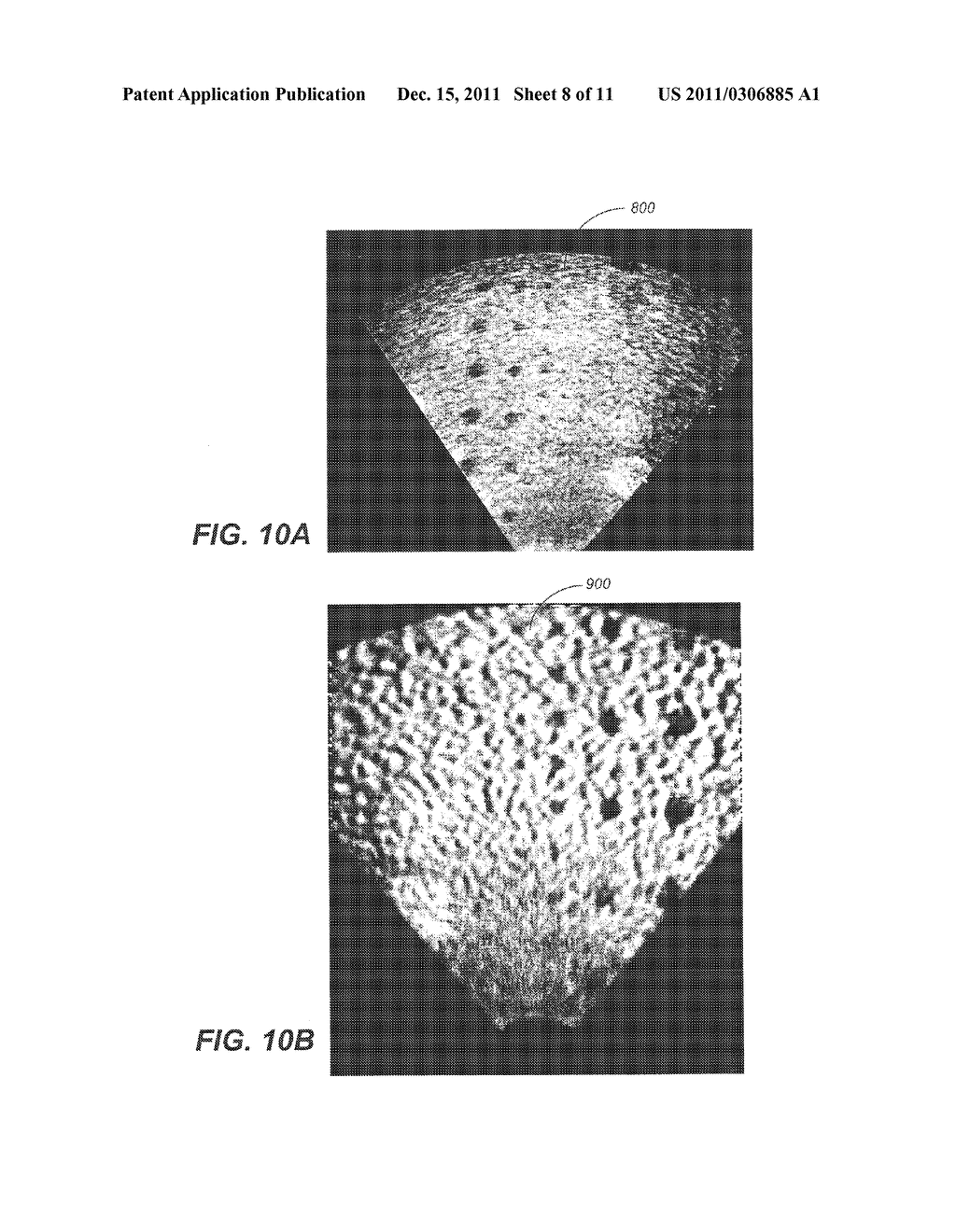 Method and Apparatus to Produce Ultrasonic Images Using Multiple Apertures - diagram, schematic, and image 09