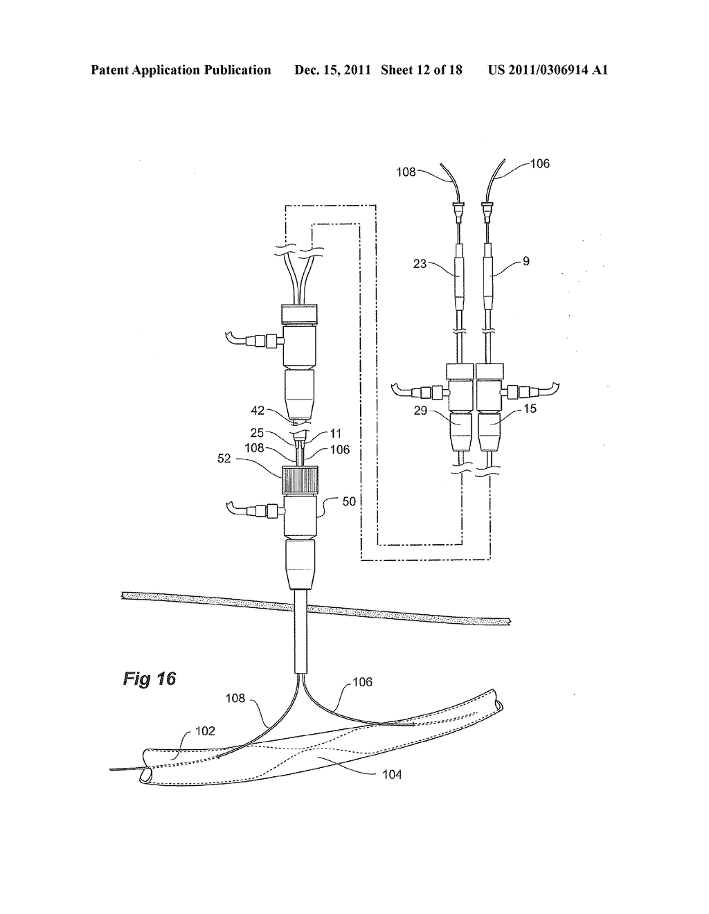 ENDOSCOPIC DELIVERY DEVICE - diagram, schematic, and image 13