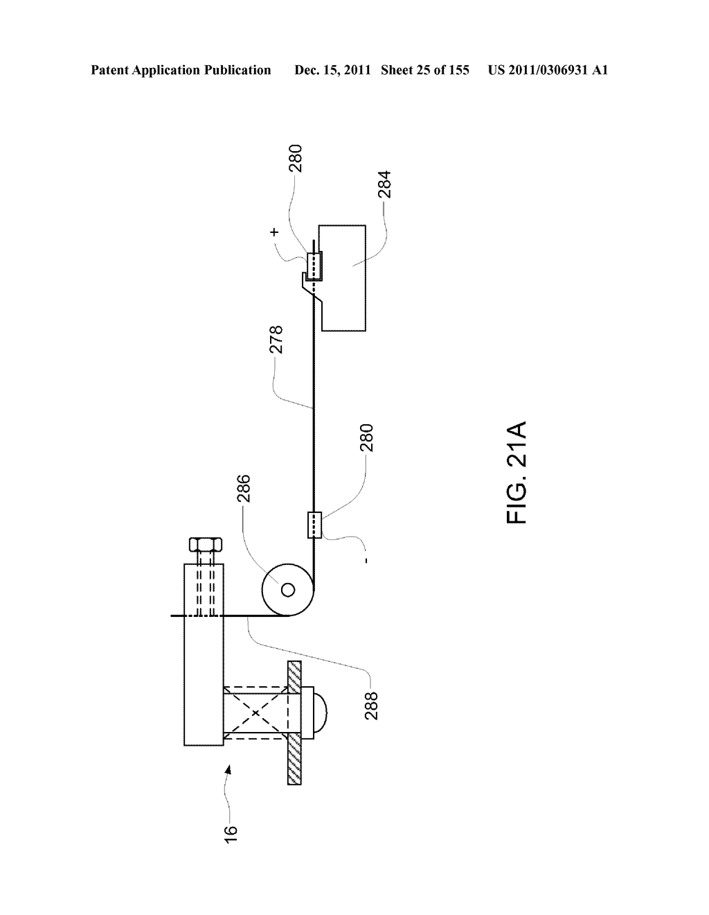 PUMPING FLUID DELIVERY SYSTEMS AND METHODS USING FORCE APPLICATION     ASSEMBLY - diagram, schematic, and image 26