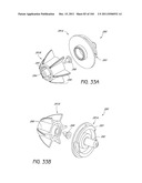 REMOVABLE CASSETTE FOR ARTICULAR INJECTION SYSTEM diagram and image