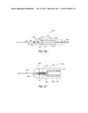 REMOVABLE CASSETTE FOR ARTICULAR INJECTION SYSTEM diagram and image