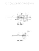 REMOVABLE CASSETTE FOR ARTICULAR INJECTION SYSTEM diagram and image