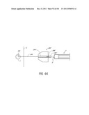 REMOVABLE CASSETTE FOR ARTICULAR INJECTION SYSTEM diagram and image