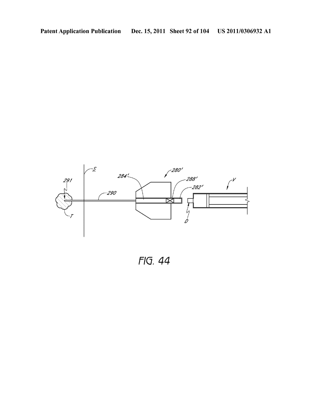 REMOVABLE CASSETTE FOR ARTICULAR INJECTION SYSTEM - diagram, schematic, and image 93