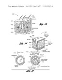 LASER-BASED METHOD AND SYSTEM FOR SELECTIVELY PROCESSING TARGET TISSUE     MATERIAL IN A PATIENT AND OPTICAL CATHETER ASSEMBLY FOR USE THEREIN diagram and image