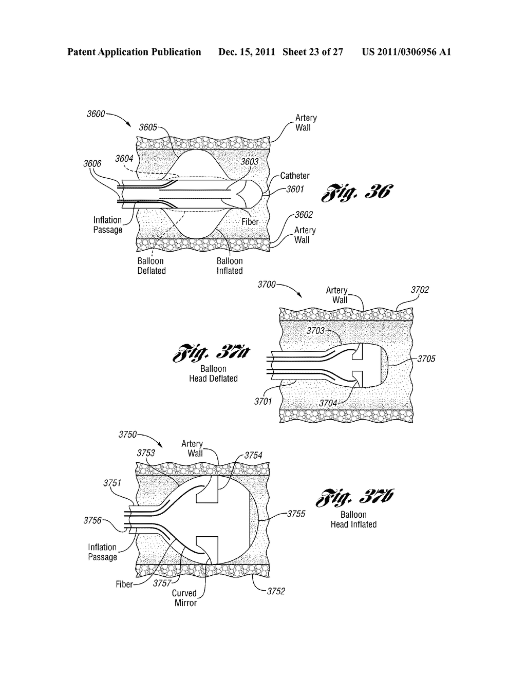 LASER-BASED METHOD AND SYSTEM FOR SELECTIVELY PROCESSING TARGET TISSUE     MATERIAL IN A PATIENT AND OPTICAL CATHETER ASSEMBLY FOR USE THEREIN - diagram, schematic, and image 24