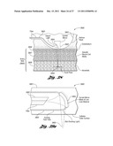 LASER-BASED METHOD AND SYSTEM FOR SELECTIVELY PROCESSING TARGET TISSUE     MATERIAL IN A PATIENT AND OPTICAL CATHETER ASSEMBLY FOR USE THEREIN diagram and image