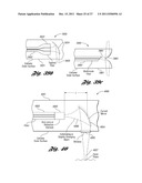 LASER-BASED METHOD AND SYSTEM FOR SELECTIVELY PROCESSING TARGET TISSUE     MATERIAL IN A PATIENT AND OPTICAL CATHETER ASSEMBLY FOR USE THEREIN diagram and image