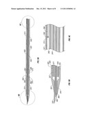 Reinforced High Strength Microwave Antenna diagram and image