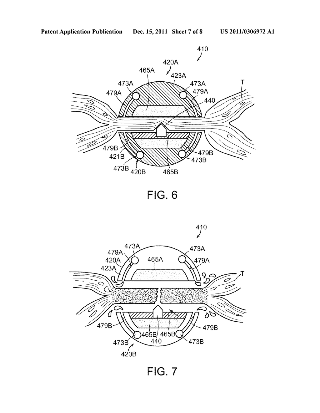 ELECTROSURGICAL INSTRUMENT EMPLOYING A THERMAL MANAGEMENT SYSTEM - diagram, schematic, and image 08