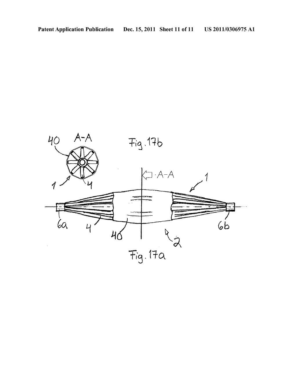 ARRANGEMENT FOR INTERNAL BONE SUPPORT - diagram, schematic, and image 12