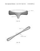 BONE PLATE AND KEEL SYSTEMS diagram and image