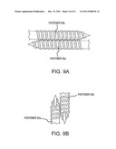 BONE PLATE AND KEEL SYSTEMS diagram and image