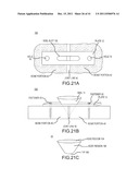 BONE PLATE AND KEEL SYSTEMS diagram and image