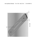 BONE PLATE AND KEEL SYSTEMS diagram and image