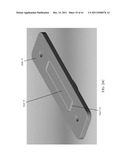 BONE PLATE AND KEEL SYSTEMS diagram and image