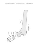 Disposable Surgical Cutter For Shaping The Head Of A Femur diagram and image