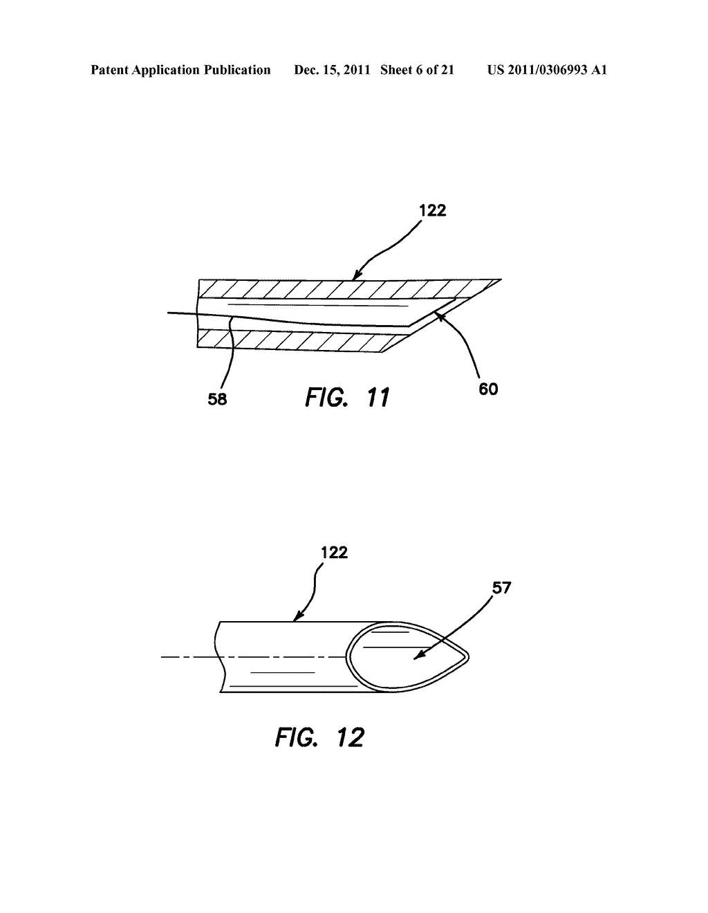 SYSTEMS AND METHODS FOR CREATING ARTERIOVENOUS (AV) FISTULAS - diagram, schematic, and image 07