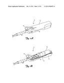 MATERIAL REMOVAL DEVICE AND METHOD OF USE diagram and image