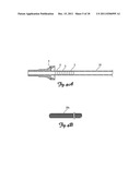 MATERIAL REMOVAL DEVICE AND METHOD OF USE diagram and image