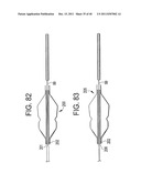 EMBOLIC PROTECTION SYSTEM diagram and image