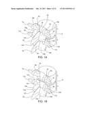 SYSTEMS AND METHODS FOR STABILIZATION OF BONE STRUCTURES diagram and image