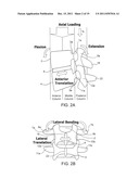 SYSTEMS AND METHODS FOR STABILIZATION OF BONE STRUCTURES diagram and image