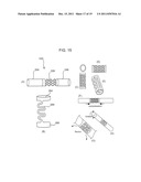 SYSTEMS AND METHODS FOR STABILIZATION OF BONE STRUCTURES diagram and image